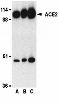 ACE2 Antibody