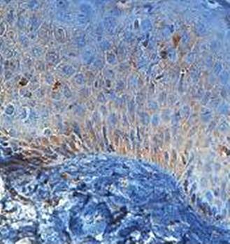 ACER1 Rabbit Polyclonal Antibody