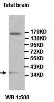 ACER3 Rabbit Polyclonal Antibody