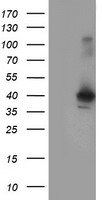 Acetyl CoA synthetase Antibody