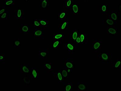 Acetyl-H2AFZ (K11) Antibody