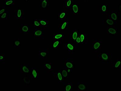 Acetyl-H2AFZ (K11) antibody