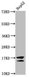 Acetyl-H2AFZ (K11) Antibody