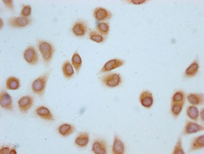Acetyl-H2AFZ (K4) Antibody