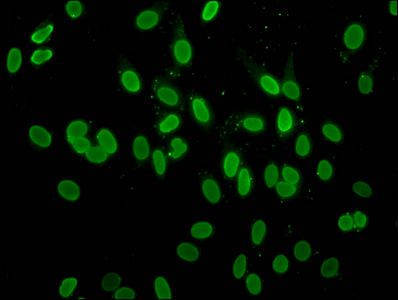 Acetyl-H2AFZ (K4) antibody