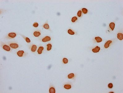 Acetyl-H2AFZ (K7) Antibody