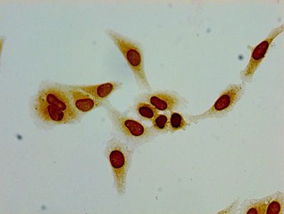 HIST1H1C Antibody