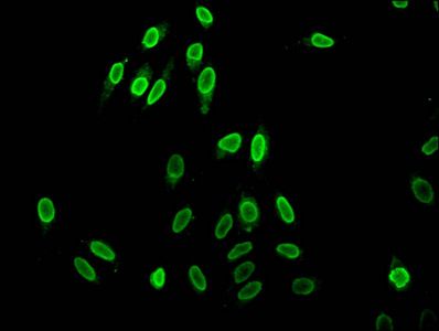 HIST1H1C Antibody