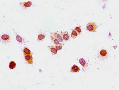 HIST1H1E Antibody