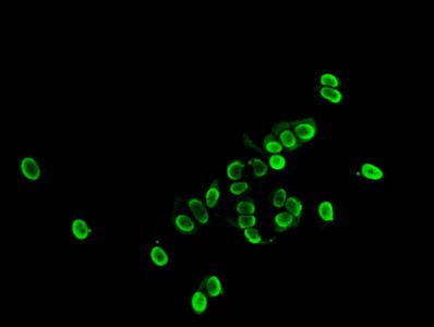 HIST1H1E Antibody
