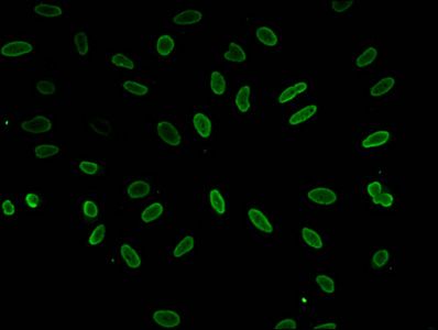 HIST1H1E Antibody