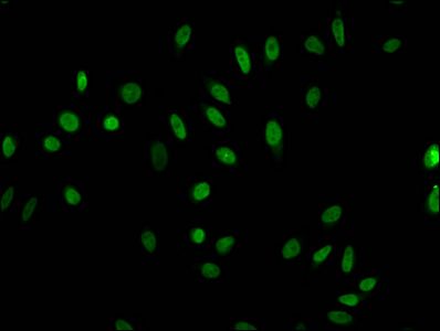 HIST1H1E Antibody