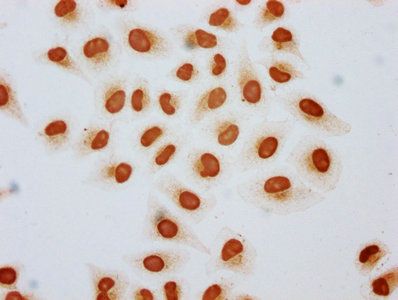 HIST1H2AG Antibody