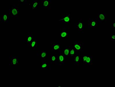 HIST1H2AG Antibody