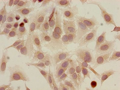 HIST1H2AG Antibody