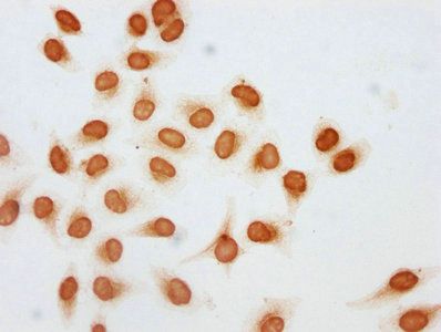 HIST1H2AG Antibody
