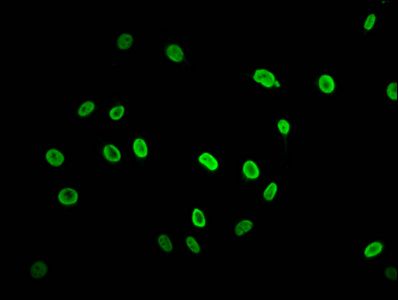 HIST1H2AG Antibody