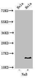 Acetyl-HIST1H2BB (K16) antibody