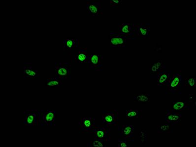 Acetyl-HIST1H2BB (K16) antibody