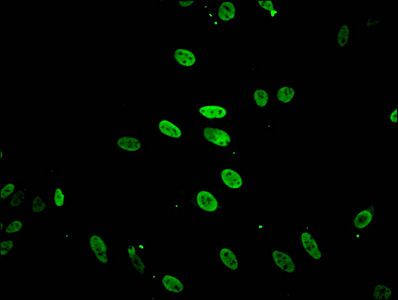 Acetyl-HIST1H2BB (K5) antibody