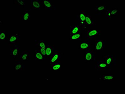 Acetyl-HIST1H2BB (K5) antibody