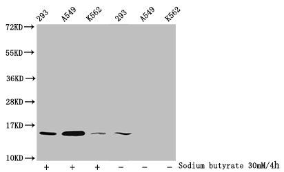 Acetyl-HIST1H2BC (K11) antibody