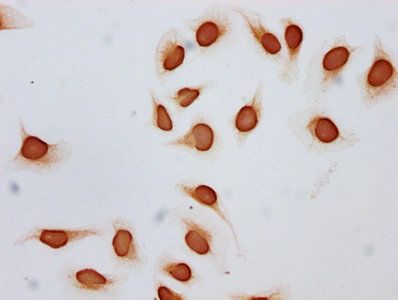 HIST1H2BC Antibody