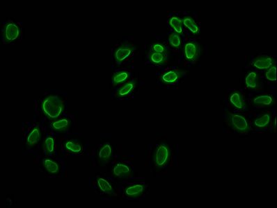 HIST1H2BC Antibody