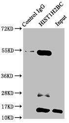 Acetyl-HIST1H2BC (K15) antibody