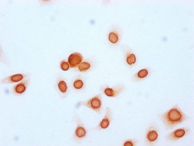 Acetyl-HIST1H2BC (K20) Antibody