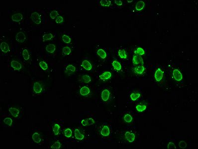 Acetyl-HIST1H2BC (K20) antibody