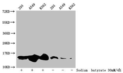 Acetyl-HIST1H2BC (K20) antibody