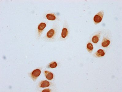 HIST1H2BC Antibody