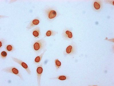 Acetyl-HIST1H3A (K115) Antibody