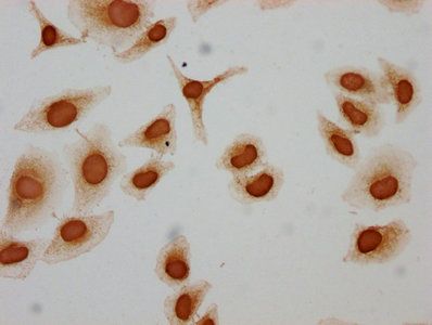 Acetyl-HIST1H3A (K122) Antibody