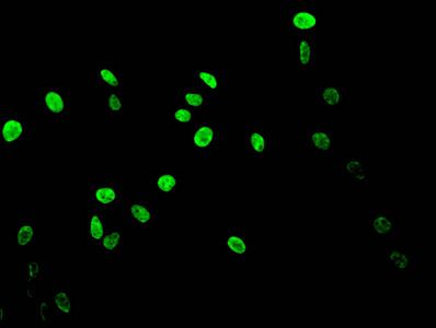 Acetyl-HIST1H3A (K14) antibody