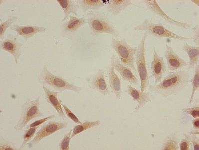 Acetyl-HIST1H3A (K18) Antibody