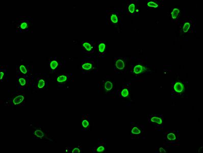 Acetyl-HIST1H3A (K27) Antibody