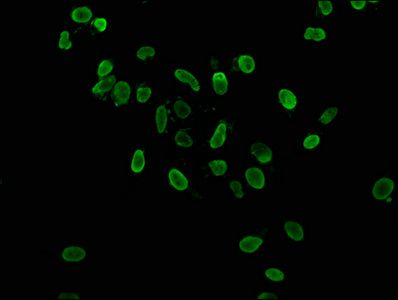 Acetyl-HIST1H3A (K36) antibody