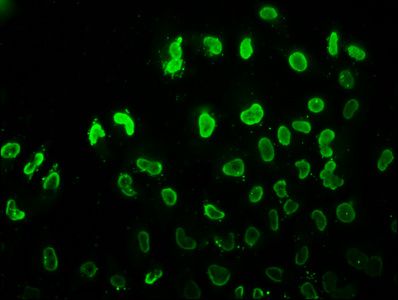 Acetyl-HIST1H3A (K37) Antibody