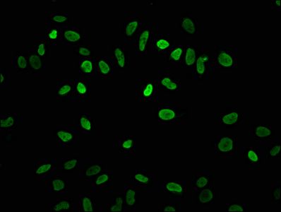 Acetyl-HIST1H3A (K4) antibody