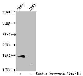 Acetyl-HIST1H3A (K56) Antibody