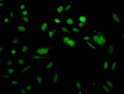 Acetyl-HIST1H3A (K64) Antibody