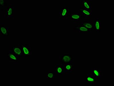 Acetyl-HIST1H3A (K79) Antibody
