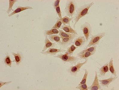Acetyl-HIST1H3A (K9) Antibody