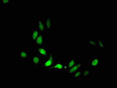 Acetyl-HIST1H3A (S28) Antibody
