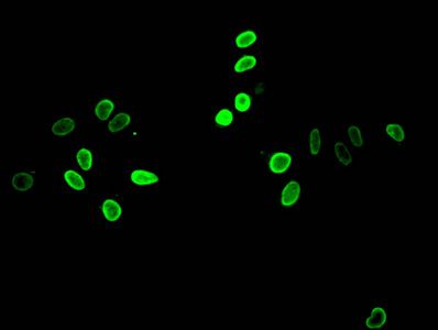HIST1H4A Antibody