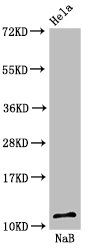 Acetyl-HIST1H4A (K16) antibody
