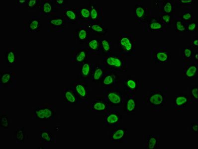 HIST1H4A Antibody