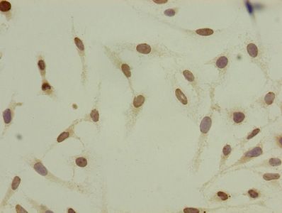 HIST1H4A Antibody
